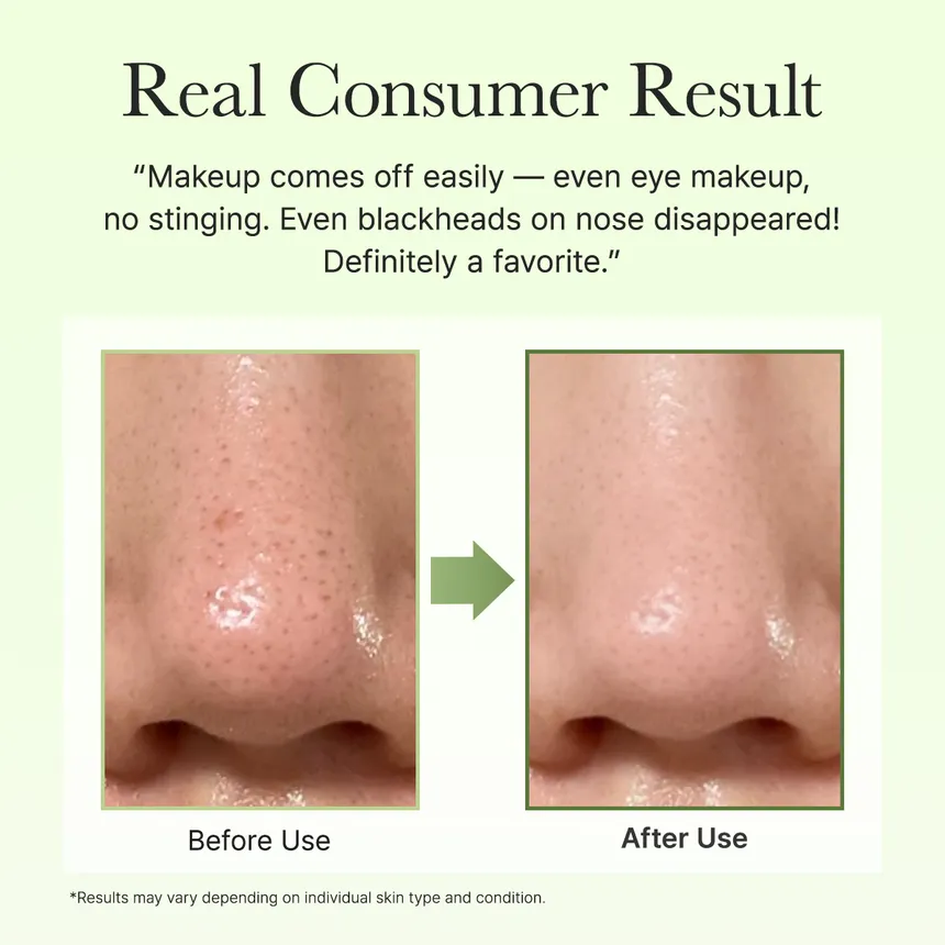 Pore Melt Phyto PDRN Cleansing Balm - Image 2