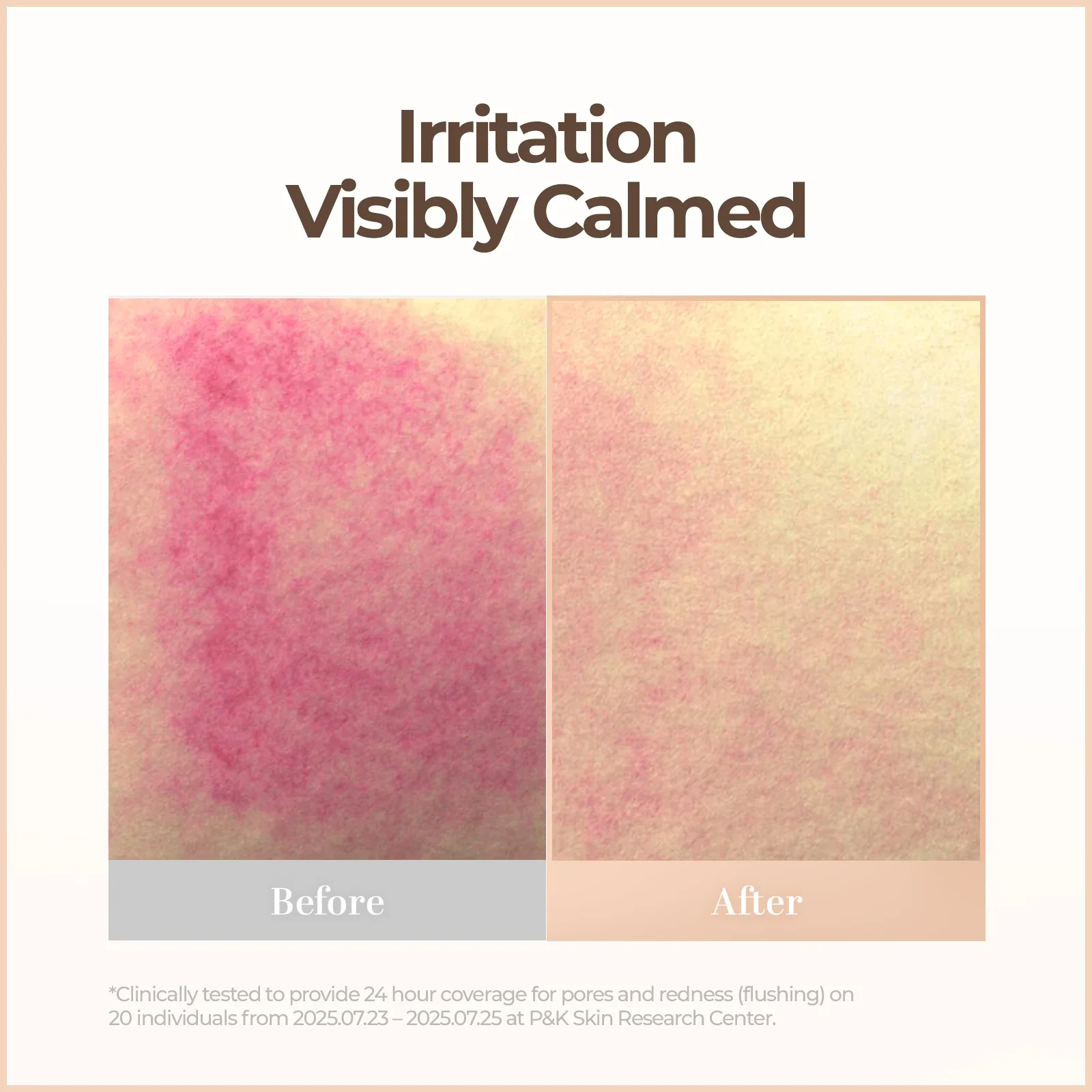 Skin Blemish Balm Intensive - Image 5