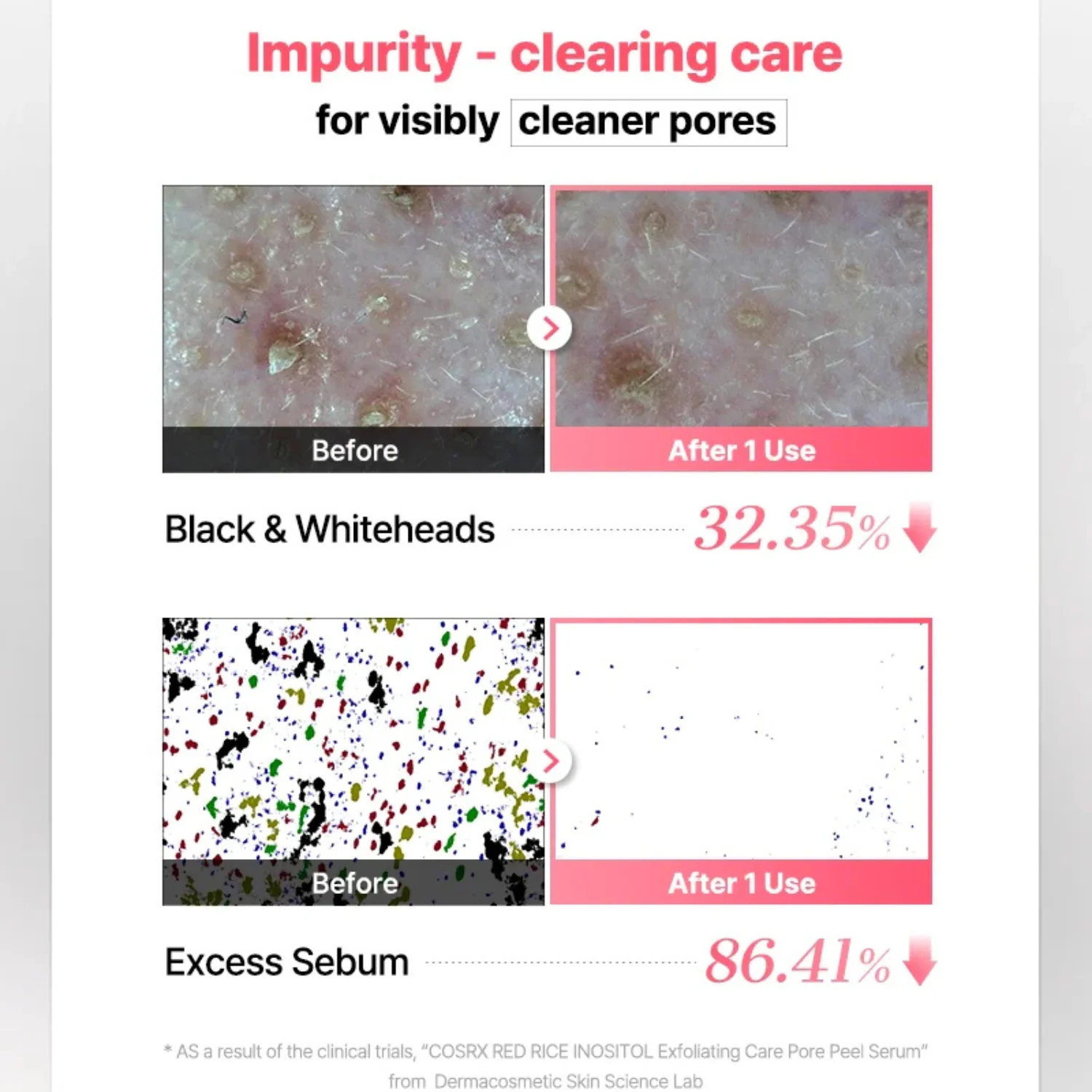 Red Rice Inositol Exfoliating Care Pore Peel Serum - Image 3