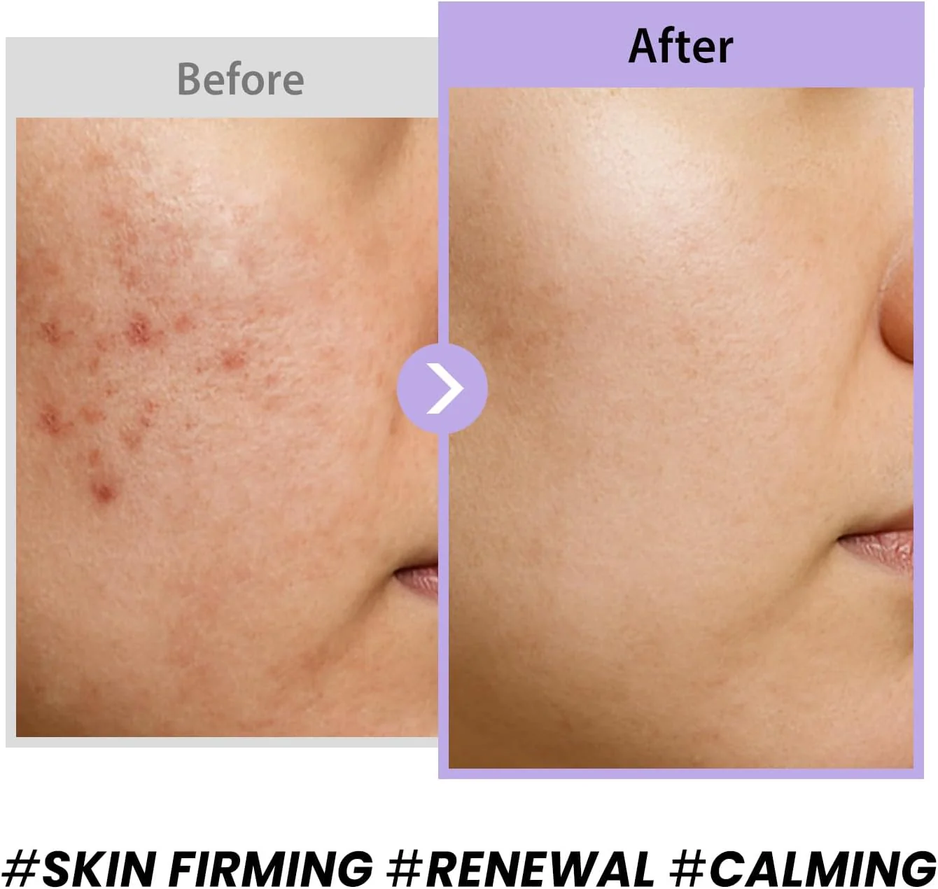 Black Snail Collagen Cream - Image 2