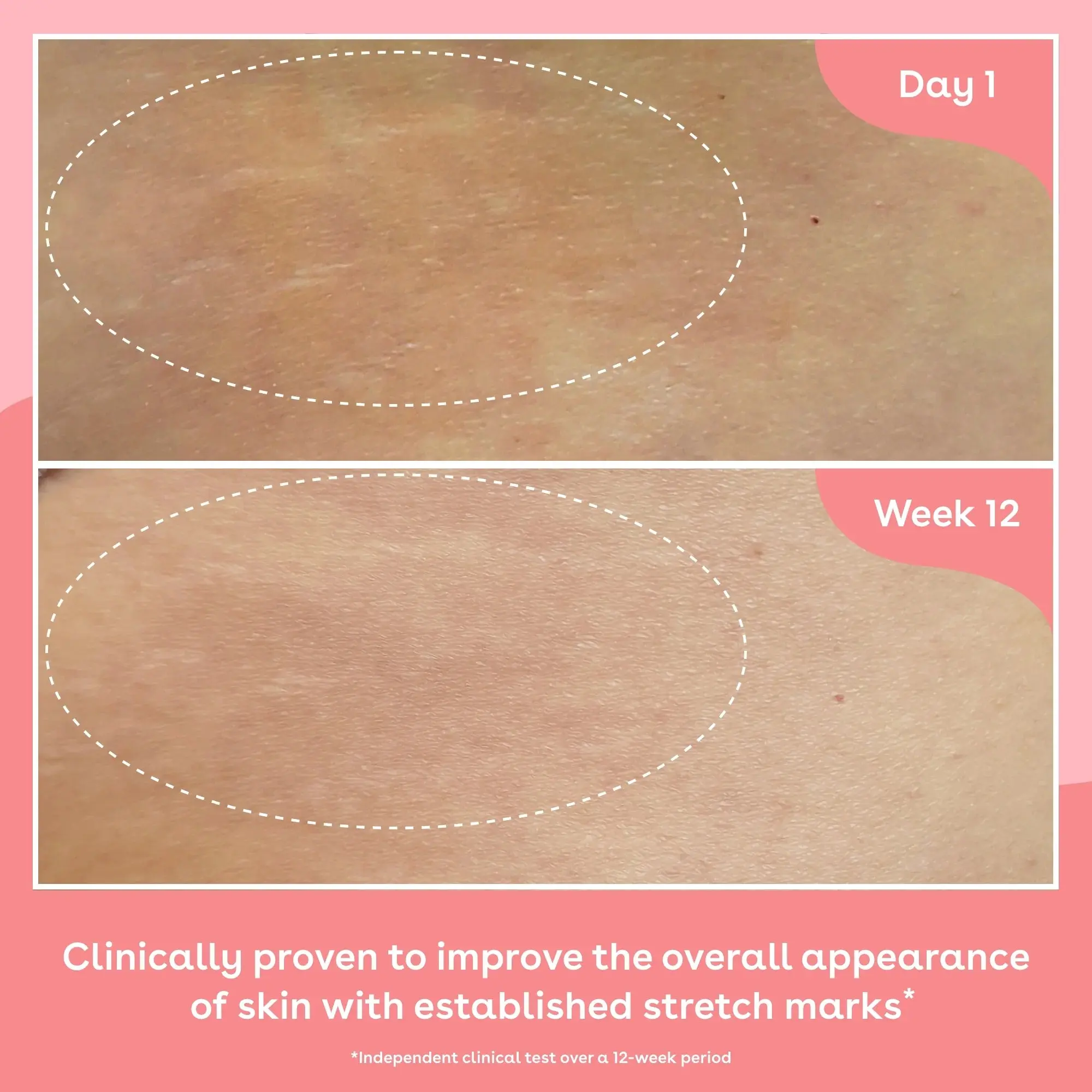 Collagen Body Oil - Image 6