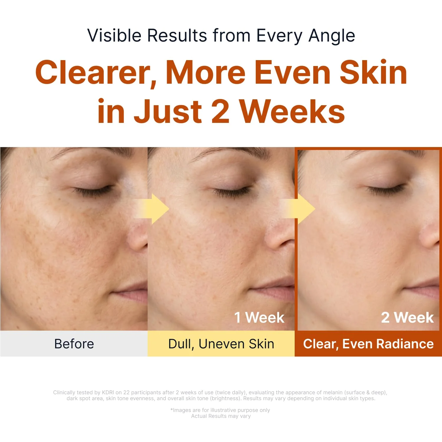 Kojic Acid Niacinamide Brightening Ampoule - Image 5