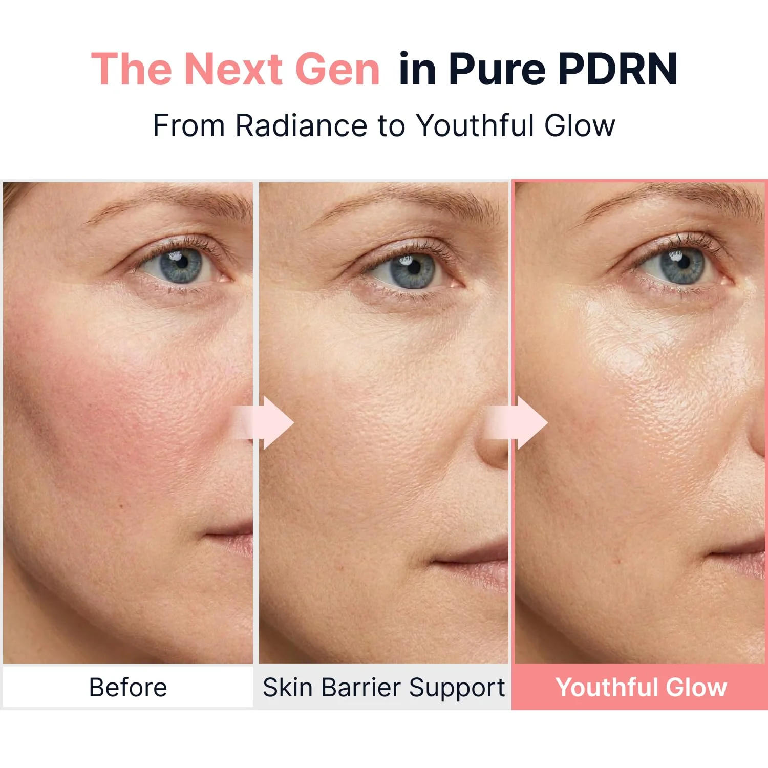 PDRN Pink Vitamin Glow Boosting Ampoule - Image 3