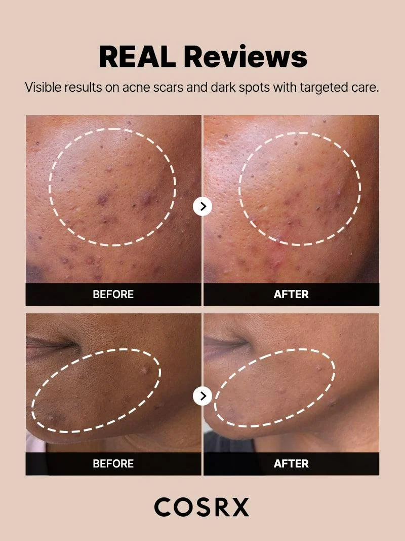 The Alpha-Arbutin 2 Discoloration Care Serum - Image 12