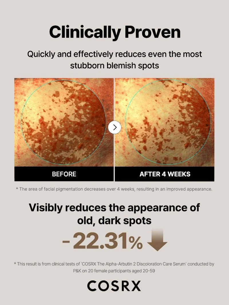 The Alpha-Arbutin 2 Discoloration Care Serum - Image 6